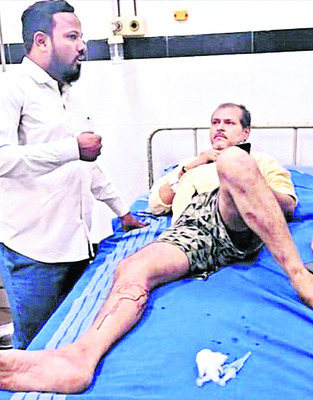 వీధి కుక్కల దాడి.. 25 మందికి గాయాలు 2
