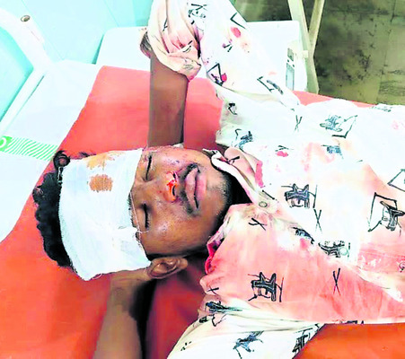 వేర్వేరు ప్రమాదాల్లో ఏడుగురికి తీవ్ర గాయాలు2