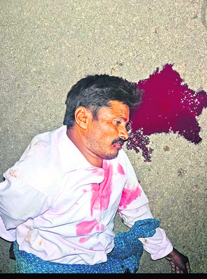 చీకట్లు నింపిన రోడ్డు ప్రమాదాలు 
1