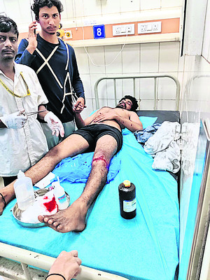 దీపావళిలో అపశ్రుతి2