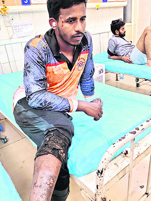 దీపావళిలో అపశ్రుతి1