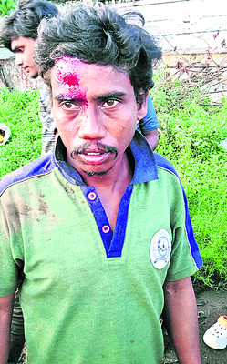 కారు ఢీకొని ఇద్దరికి గాయాలు 1