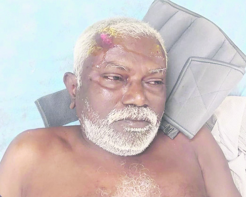 వీఆర్ఓకు తీవ్ర గాయాలు    
2