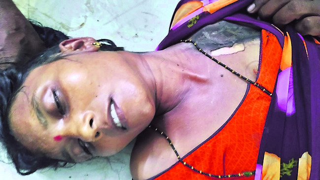 రోడ్ల మరమ్మతులకు  రూ. 74.20 కోట్లు   1