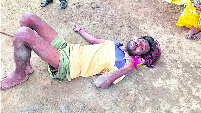 తల్లీకొడుకుపై    గొడ్డలితో దాడి
1