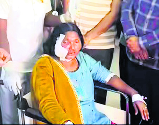 కులగణనలో కుక్కల దాడి1
