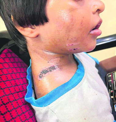 సినీ నటిపై దాడి.. యువకుడిపై కేసు 
1