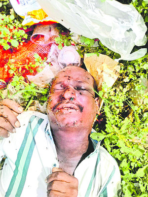 ఎలా చనిపోయారో?1