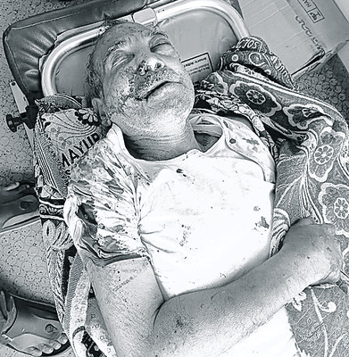 తండ్రిపై తనయుడి దాడి1