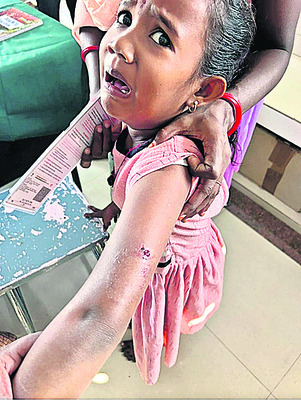 వడ్డాదిలో పిచ్చి కుక్క స్వైర విహారం 2