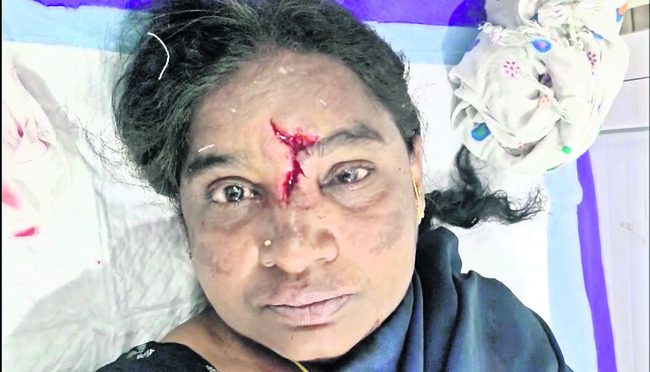 కోదాడ ఆర్టీసీ బస్టాండ్‌లో ప్రమాదం1