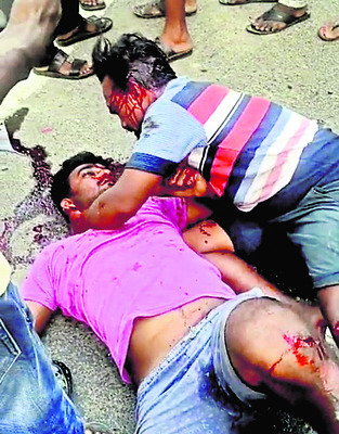 గుర్తు తెలియని వాహనం ఢీకొని ఇరువురికి గాయాలు   2