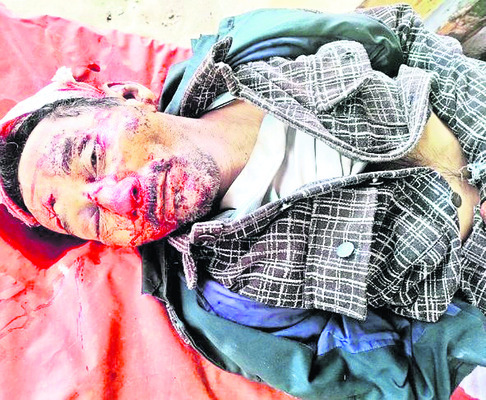 విద్యుత్‌ షార్ట్‌ సర్క్యూట్‌తో యువకుడి మృతి 2