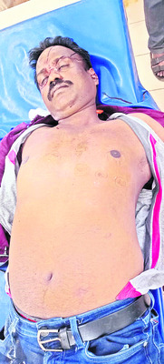 రైలు నుంచి జారిపడి వ్యక్తి మృతి   1