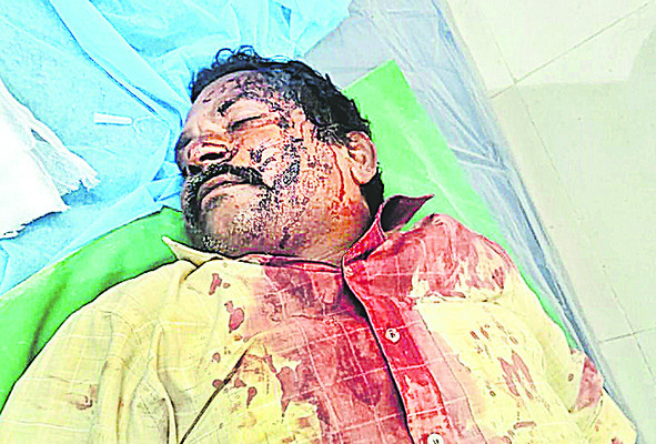 ఇనుప రాడ్లు, రాళ్లతో కొట్టుకున్న టీడీపీ నేతలు 1