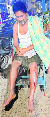 ఇనుప రాడ్లు, రాళ్లతో కొట్టుకున్న టీడీపీ నేతలు 2