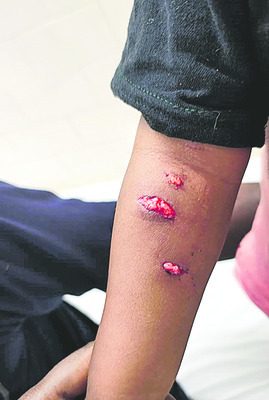 యూనిటీ మార్చ్‌కు రమేశ్‌ ఎంపిక 1