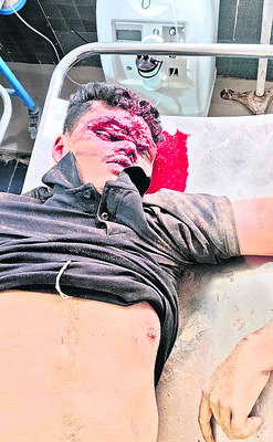 బతుకుదెరువు కోసం వచ్చి బలయ్యారు!2