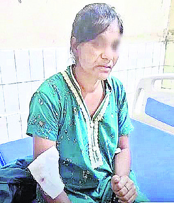 కుక్కల దాడిలో మహిళకు తీవ్ర గాయాలు1