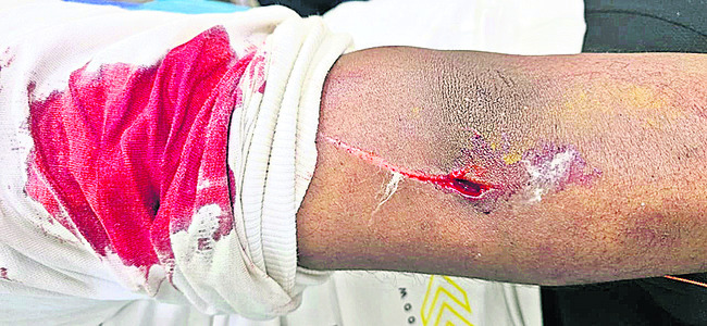 మచ్చు కత్తితో టీడీపీ నేత దాడి 1