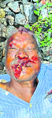 వ్యక్తి ఆత్మహత్య2