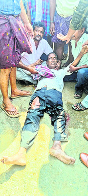 వేర్వేరు ప్రమాదాల్లో ఇద్దరికి గాయాలు1