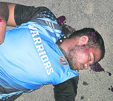 వేర్వేరు రోడ్డు ప్రమాదాల్లో ఏడుగురికి గాయాలు2