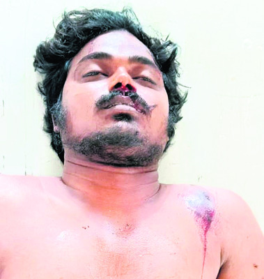 ఇథనాల్‌ ట్యాంకర్‌ బోల్తా 2