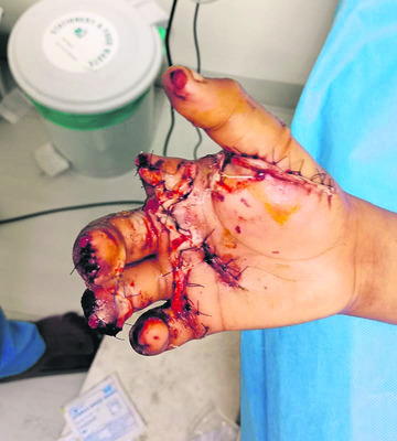 పేద కుటుంబానికి పెద్ద కష్టం1