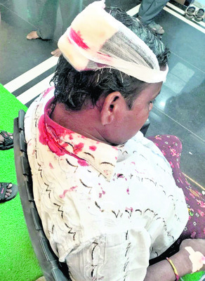 త్రుటిలో తప్పిన ప్రమాదం2