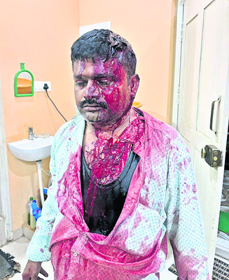 మీటర్‌ రీడర్‌పై పాశవిక దాడి 2