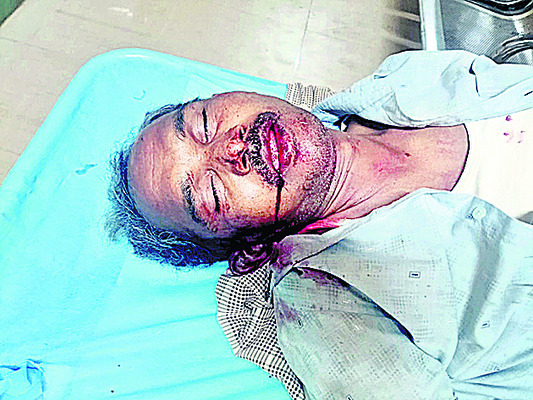 చికిత్స పొందుతూ ఉపాధి  ఫీల్డ్‌ అసిస్టెంట్‌ మృతి2