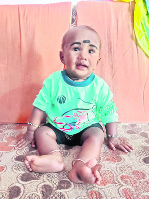 కాలిన గాయాలతో తల్లీకొడుకు మృతి 1