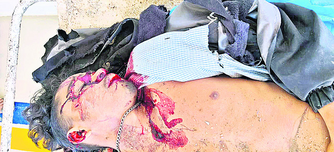 రామనగుడలో ఘోర రోడ్డు ప్రమాదం 1