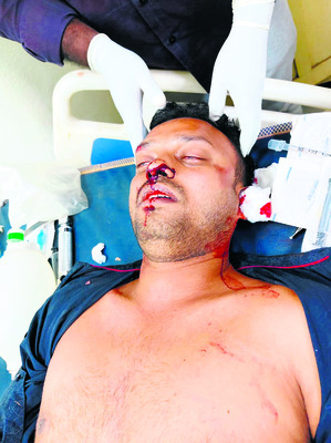 ఉద్యానశాఖలో నిధుల వ్యయంపై ఏజీ ఆడిట్‌ 2