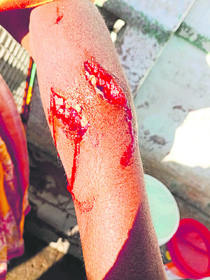 ముందు 7.. రీకౌంటింగ్‌ తర్వాత 22