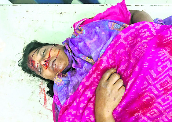 వాటర్‌ ప్లాంట్‌లోకి  దూసుకెళ్లిన లారీ  1