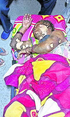 పూరిల్లు దగ్ధం: వృద్ధురాలికి గాయాలు1