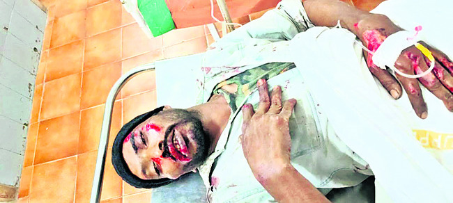 వేర్వేరు రోడ్డు ప్రమాదాల్లో  నలుగురికి తీవ్ర గాయాలు
1