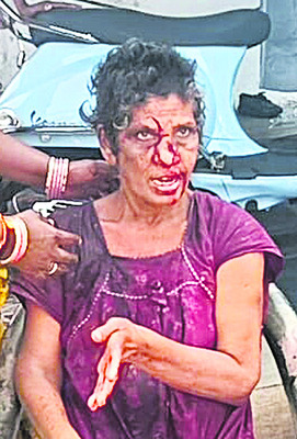 శ్లాబ్‌ పెచ్చులూడిపడి మహిళకు తీవ్ర గాయాలు 1