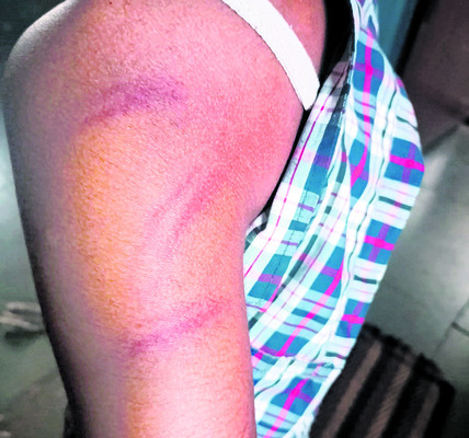 విద్యార్థిని  చితకబాదిన టీచర్‌ 1