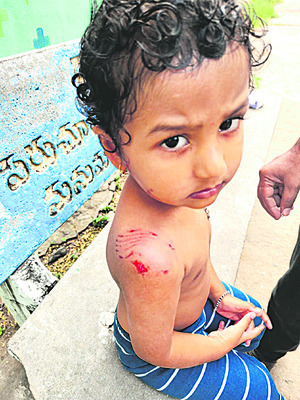 పిచ్చికుక్క స్వైర విహారం 2