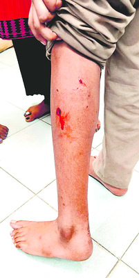 పిచ్చికుక్క స్వైర విహారం 1