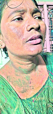 పొలం వివాదంలో దళిత కుటుంబంపై దాడి 1