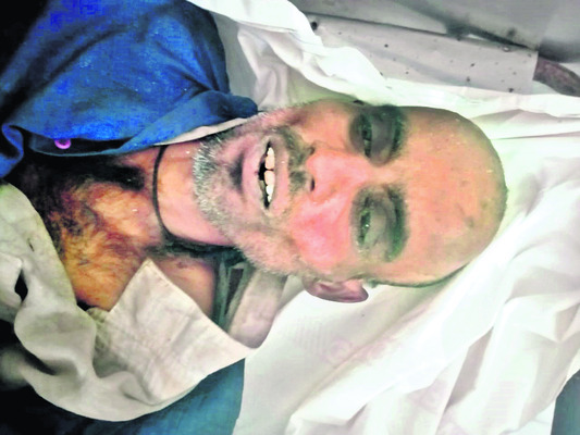 రిమ్స్‌ మార్చురీలో  వ్యక్తి మృతదేహం2