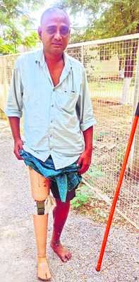 అభాగ్యులకు అందని పింఛన్‌ 3