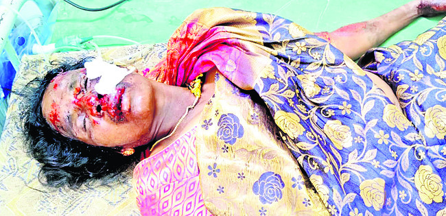 కుక్క అడ్డురావడంతో..   1