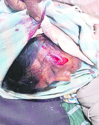 ఇసుక తరలిస్తున్నారని కర్రలతో దాడి 1