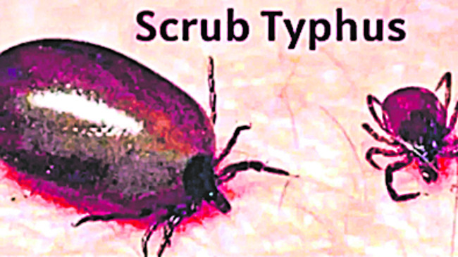 భయపెడుతున్న స్క్రబ్‌ టైఫస్‌1