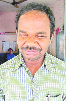 వైకల్యంపై గెలిచిన సంకల్పం 3